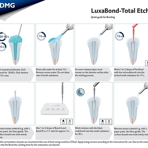 اینتروکیت باندینگ نسل چهارم DMG - LuxaBond Total Etch